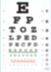 Dr. Barry G. Chaiken, M.D. | AdvancedVue™ | LASIK